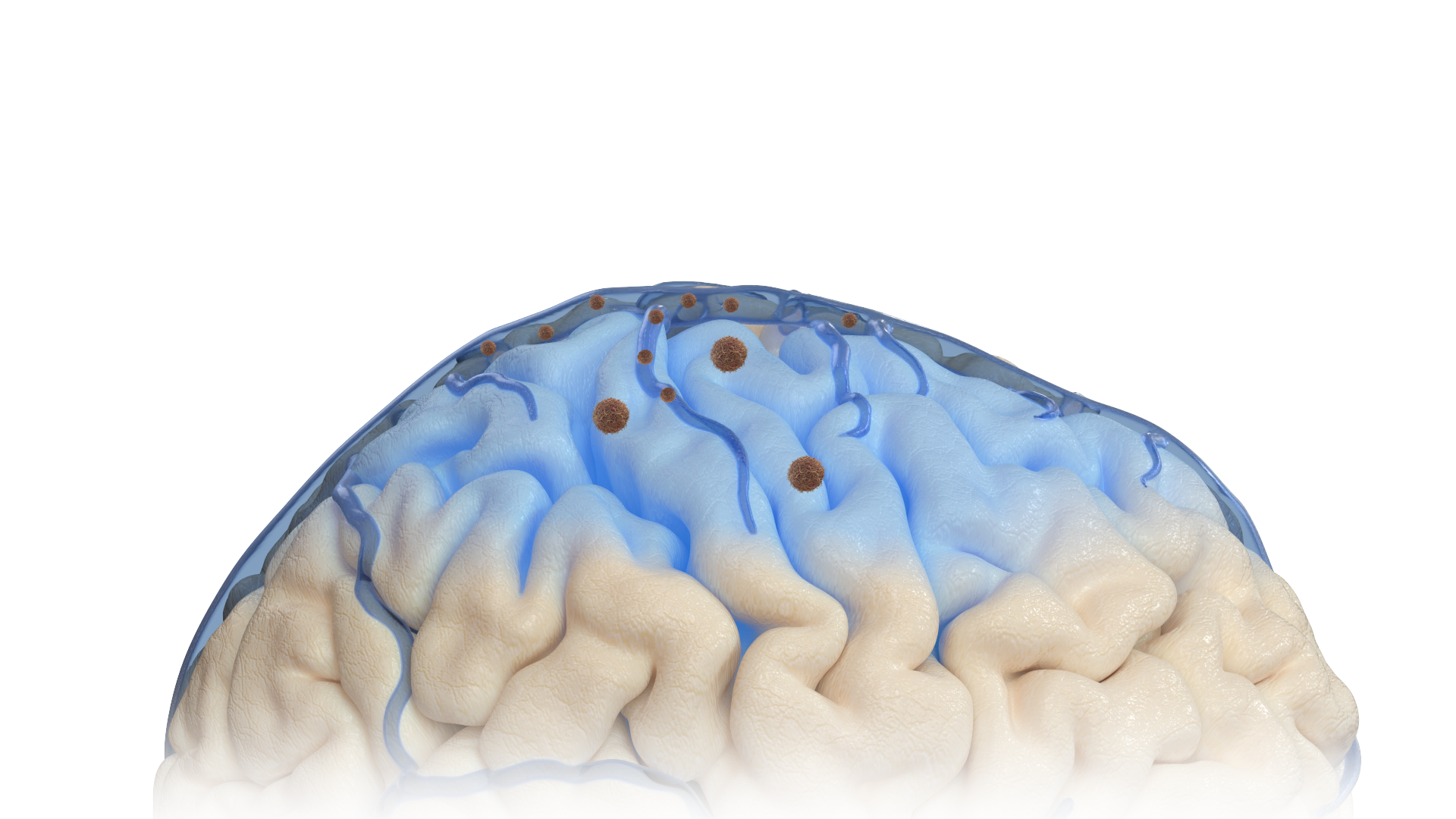 Brain